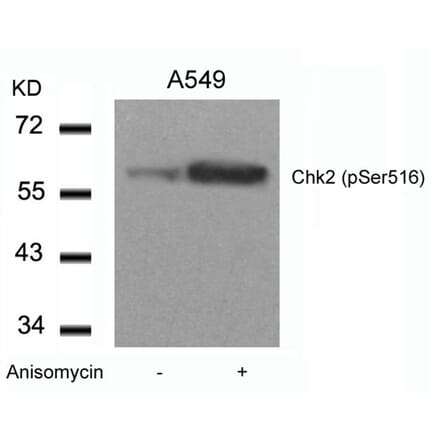 Western blot - Chk2 (Phospho-Ser516) Antibody from Signalway Antibody (11147) - Antibodies.com