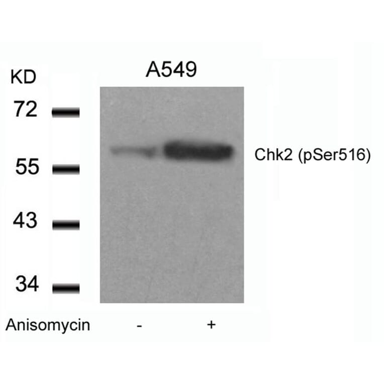 Western blot - Chk2 (Phospho-Ser516) Antibody from Signalway Antibody (11147) - Antibodies.com