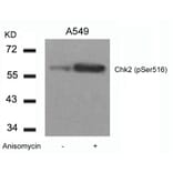 Western blot - Chk2 (Phospho-Ser516) Antibody from Signalway Antibody (11147) - Antibodies.com