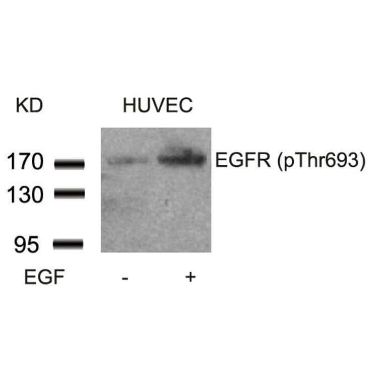 Western blot - EGFR (Phospho-Thr693) Antibody from Signalway Antibody (11187) - Antibodies.com