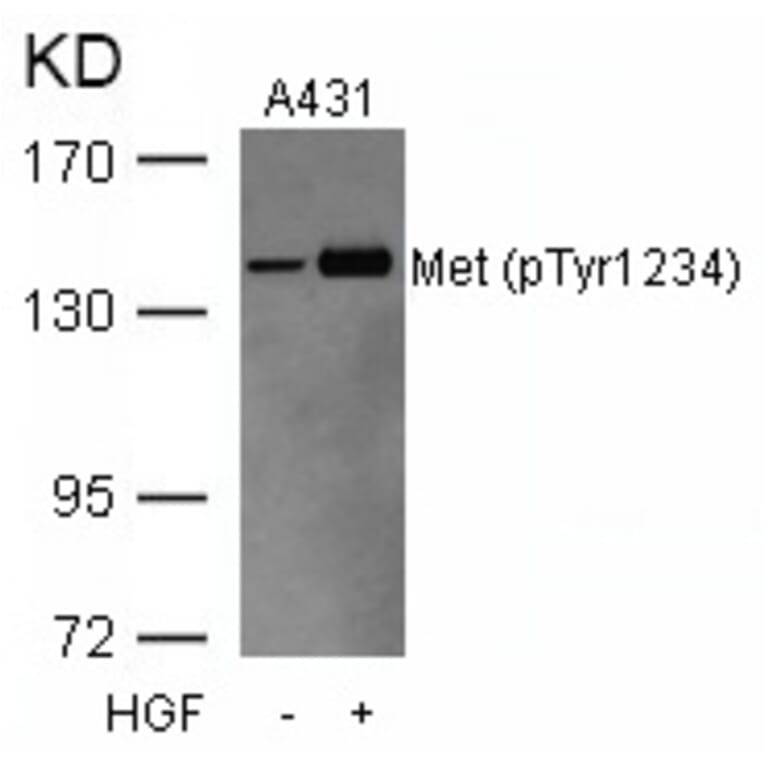 Western blot - Met (Phospho-Tyr1234) Antibody from Signalway Antibody (11227) - Antibodies.com