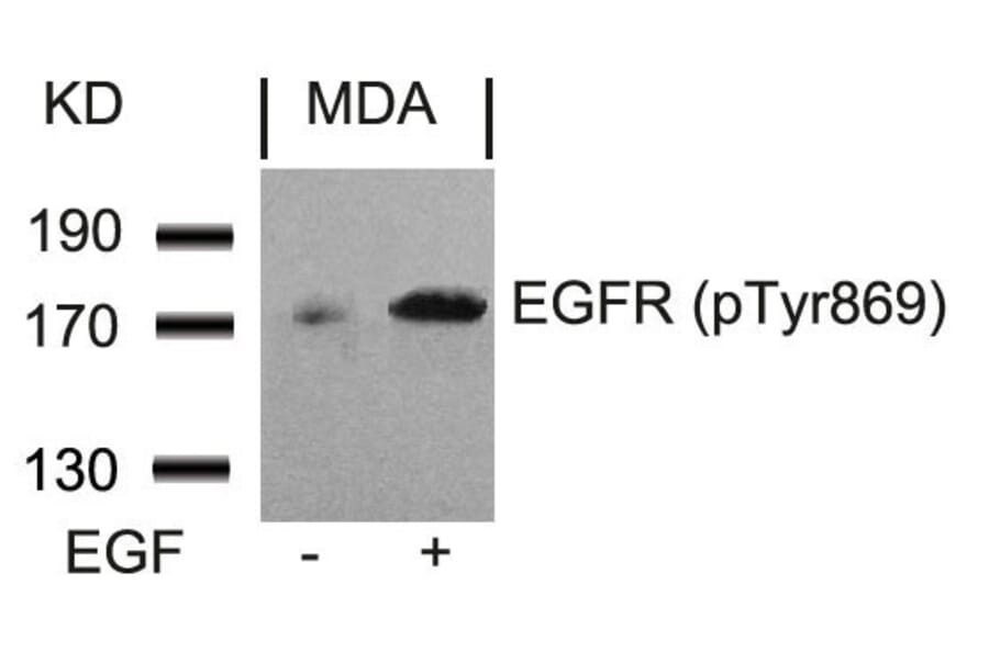 Western blot - EGFR (Phospho-Tyr869) Antibody from Signalway Antibody (11229) - Antibodies.com