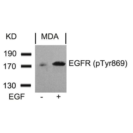 Western blot - EGFR (Phospho-Tyr869) Antibody from Signalway Antibody (11229) - Antibodies.com