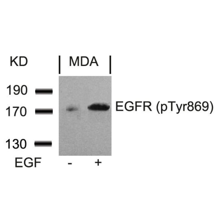 Western blot - EGFR (Phospho-Tyr869) Antibody from Signalway Antibody (11229) - Antibodies.com