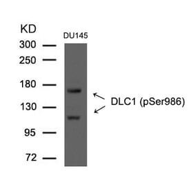 Western blot - DLC1 (Phospho-Ser986) Antibody from Signalway Antibody (11592) - Antibodies.com