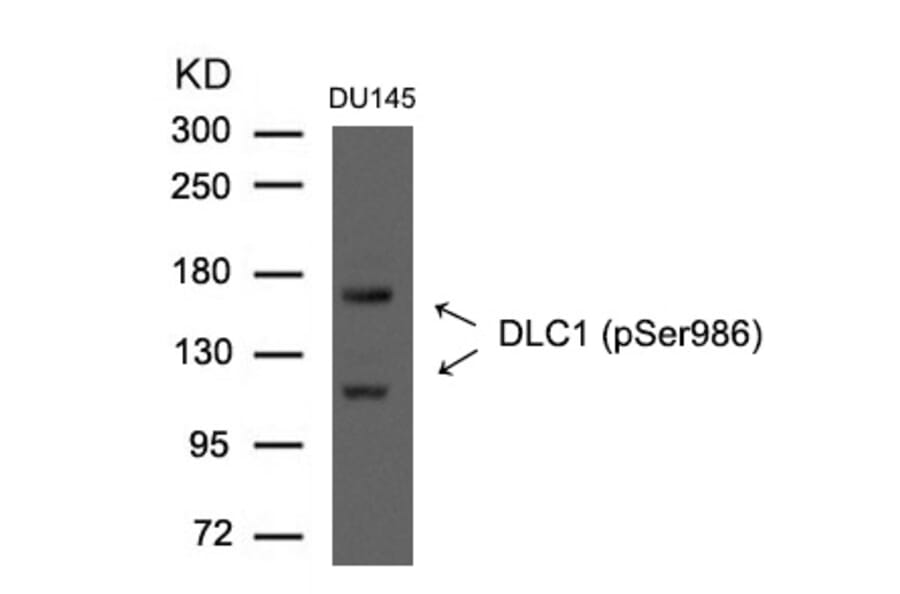 Western blot - DLC1 (Phospho-Ser986) Antibody from Signalway Antibody (11592) - Antibodies.com