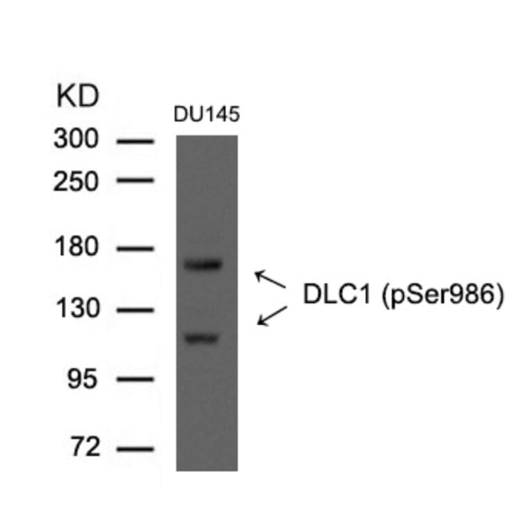 Western blot - DLC1 (Phospho-Ser986) Antibody from Signalway Antibody (11592) - Antibodies.com