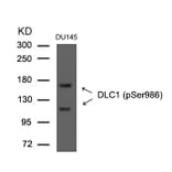 Western blot - DLC1 (Phospho-Ser986) Antibody from Signalway Antibody (11592) - Antibodies.com