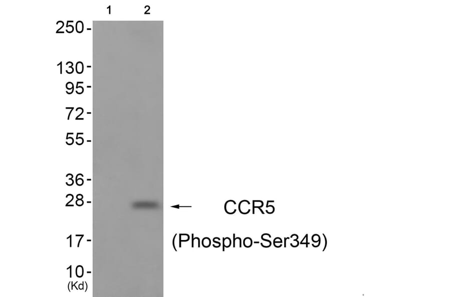 Western blot - CCR5 (Phospho-Ser349) Antibody from Signalway Antibody (11650) - Antibodies.com