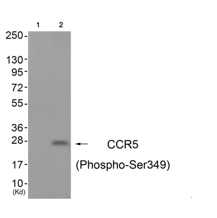 Western blot - CCR5 (Phospho-Ser349) Antibody from Signalway Antibody (11650) - Antibodies.com