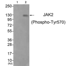 Western blot - JAK2 (Phospho-Tyr570) Antibody from Signalway Antibody (11663) - Antibodies.com