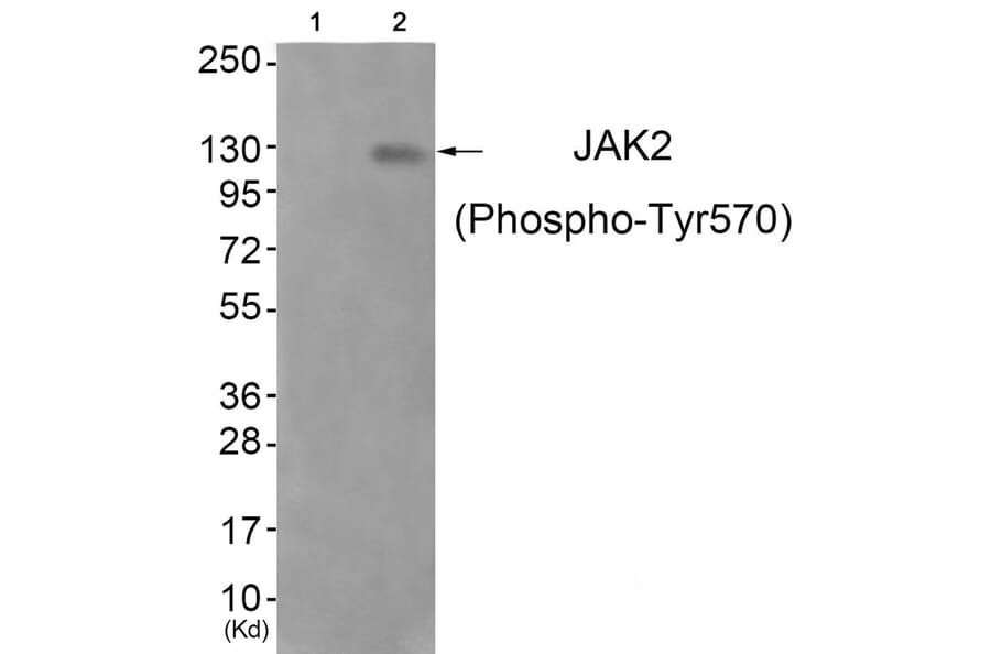 Western blot - JAK2 (Phospho-Tyr570) Antibody from Signalway Antibody (11663) - Antibodies.com