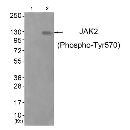 Western blot - JAK2 (Phospho-Tyr570) Antibody from Signalway Antibody (11663) - Antibodies.com