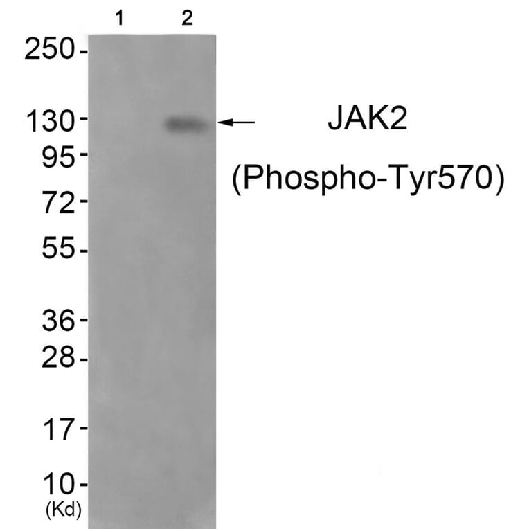 Western blot - JAK2 (Phospho-Tyr570) Antibody from Signalway Antibody (11663) - Antibodies.com
