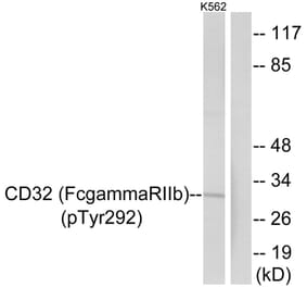 Western blot - CD32 (Phospho-Tyr292) Antibody from Signalway Antibody (11672) - Antibodies.com
