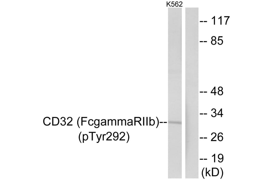 Western blot - CD32 (Phospho-Tyr292) Antibody from Signalway Antibody (11672) - Antibodies.com