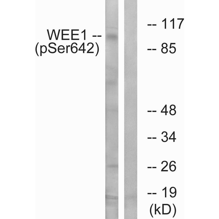 Western blot - WEE1 (Phospho-Ser642) Antibody from Signalway Antibody (11706) - Antibodies.com