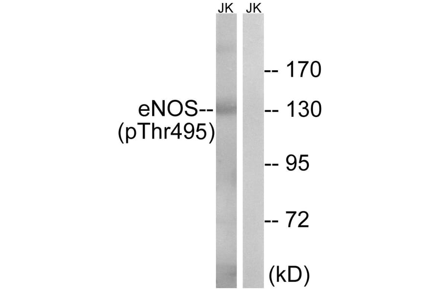 Western blot - eNOS (Phospho-Thr495) Antibody from Signalway Antibody (11711) - Antibodies.com