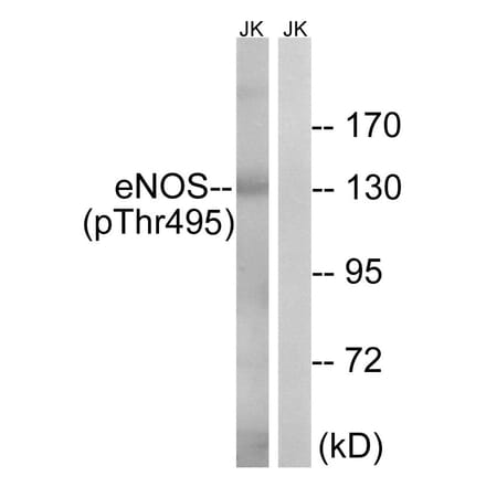 Western blot - eNOS (Phospho-Thr495) Antibody from Signalway Antibody (11711) - Antibodies.com