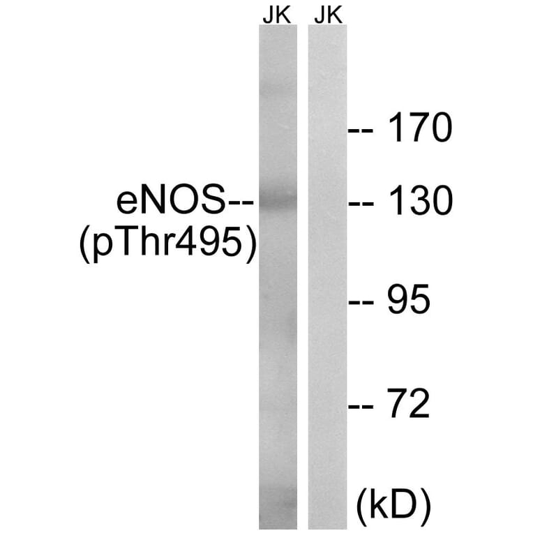 Western blot - eNOS (Phospho-Thr495) Antibody from Signalway Antibody (11711) - Antibodies.com