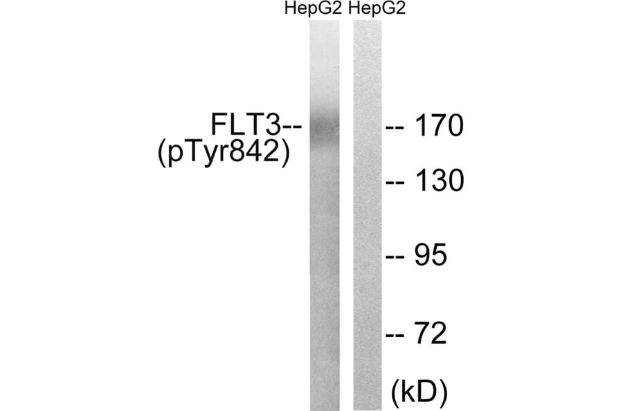 Western blot - FLT3 (Phospho-Tyr842) Antibody from Signalway Antibody (11731) - Antibodies.com