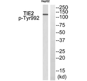 Western blot - TIE2 (Phospho-Tyr992) Antibody from Signalway Antibody (11756) - Antibodies.com