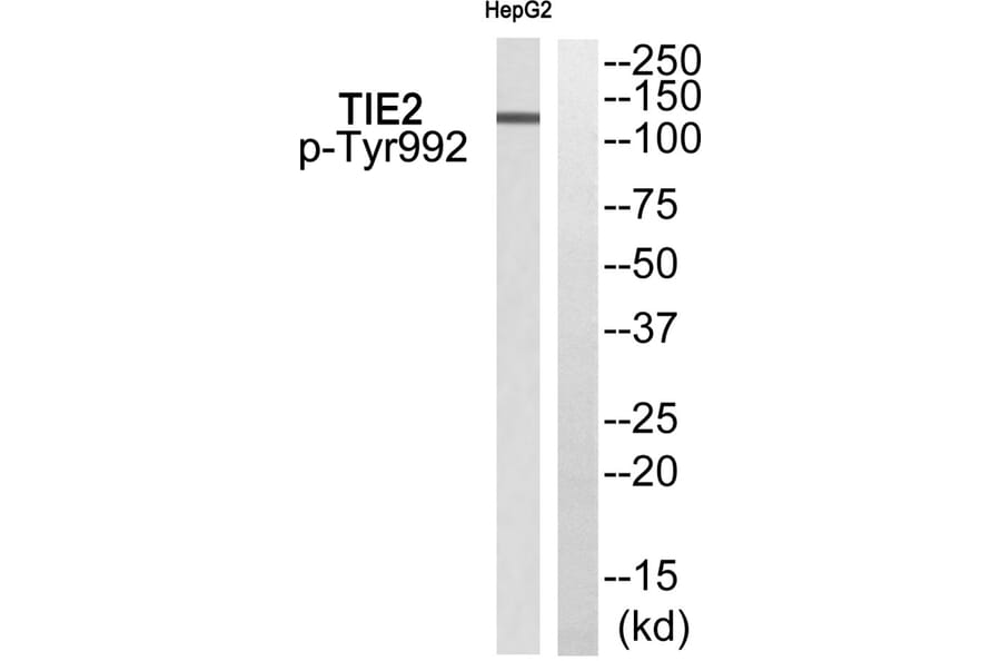 Western blot - TIE2 (Phospho-Tyr992) Antibody from Signalway Antibody (11756) - Antibodies.com
