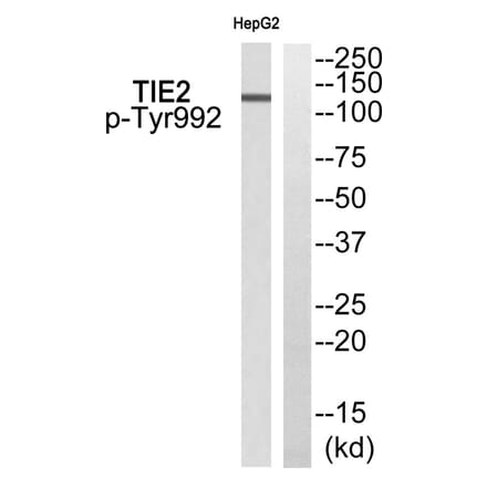 Western blot - TIE2 (Phospho-Tyr992) Antibody from Signalway Antibody (11756) - Antibodies.com