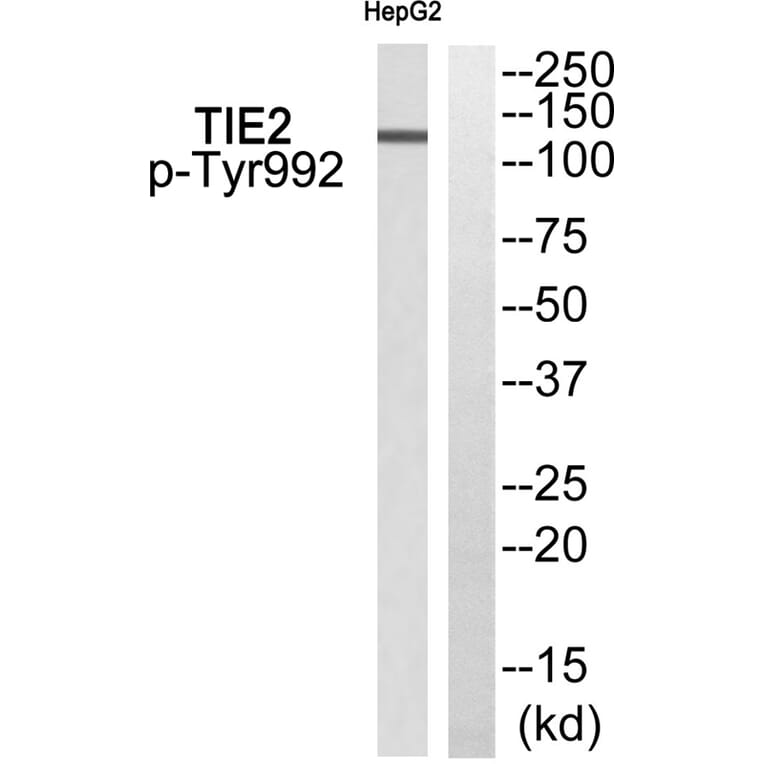 Western blot - TIE2 (Phospho-Tyr992) Antibody from Signalway Antibody (11756) - Antibodies.com