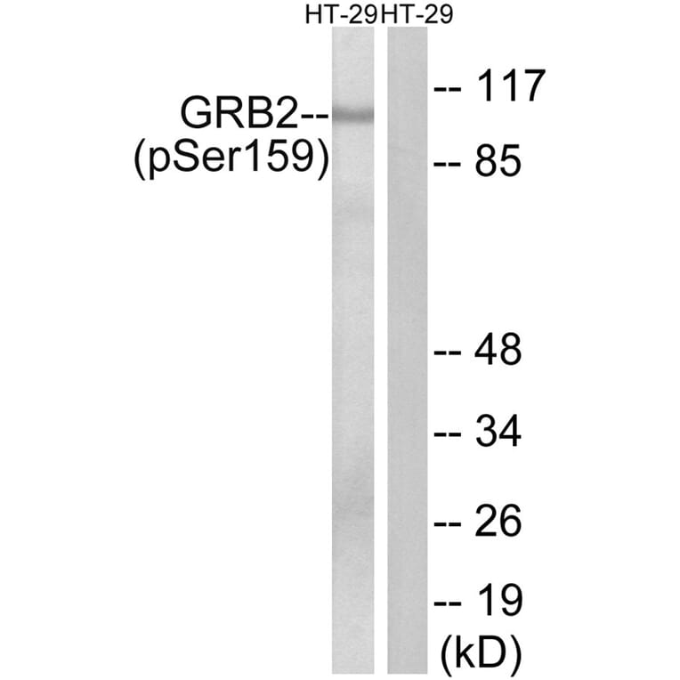 Western blot - GRB2 (Phospho-Ser159) Antibody from Signalway Antibody (11771) - Antibodies.com