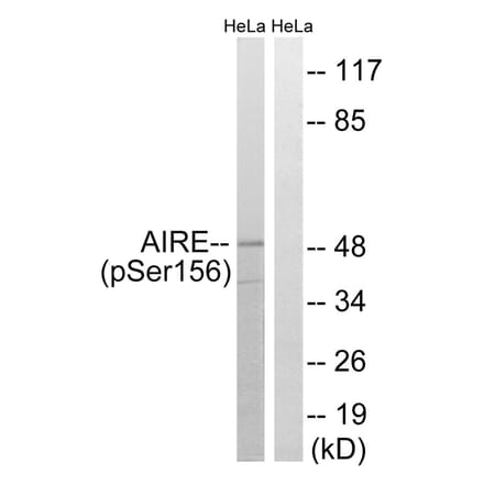 Western blot - AIRE (Phospho-Ser156) Antibody from Signalway Antibody (11782) - Antibodies.com