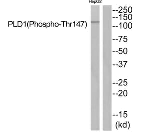 Western blot - PLD1 (Phospho-Thr147) Antibody from Signalway Antibody (11818) - Antibodies.com