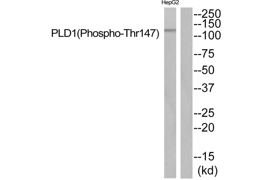 Western blot - PLD1 (Phospho-Thr147) Antibody from Signalway Antibody (11818) - Antibodies.com