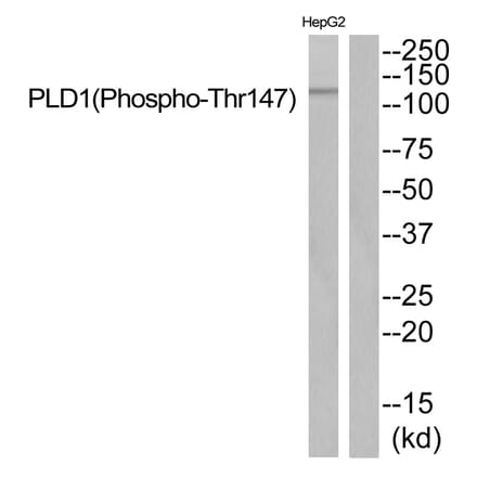 Western blot - PLD1 (Phospho-Thr147) Antibody from Signalway Antibody (11818) - Antibodies.com
