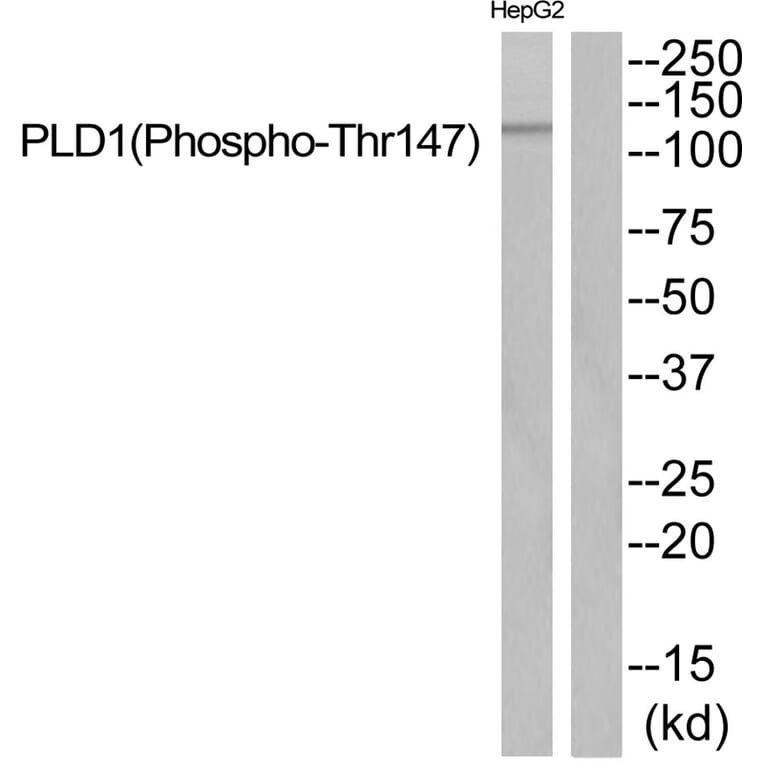 Western blot - PLD1 (Phospho-Thr147) Antibody from Signalway Antibody (11818) - Antibodies.com