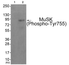 Western blot - MuSK (Phospho-Tyr755) Antibody from Signalway Antibody (11837) - Antibodies.com