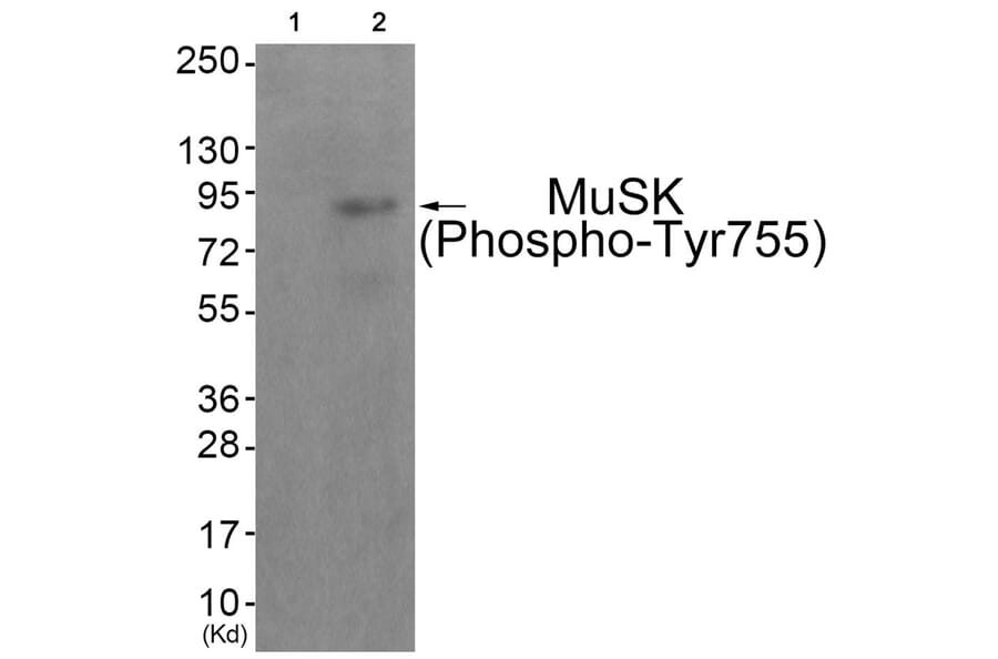 Western blot - MuSK (Phospho-Tyr755) Antibody from Signalway Antibody (11837) - Antibodies.com