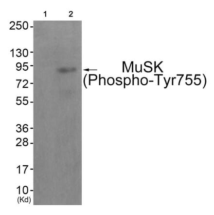 Western blot - MuSK (Phospho-Tyr755) Antibody from Signalway Antibody (11837) - Antibodies.com