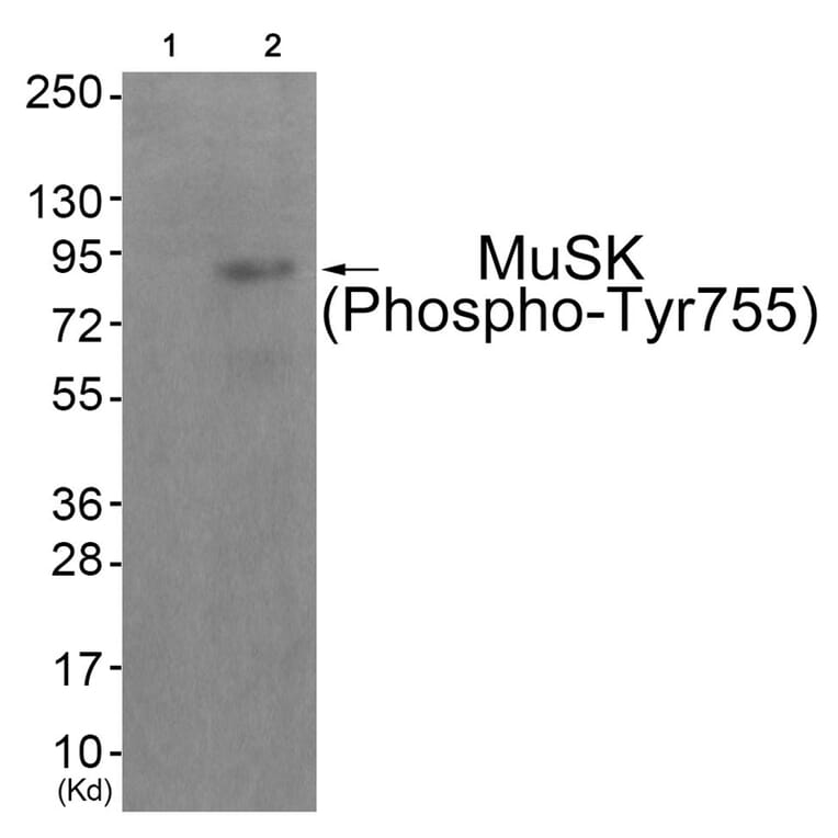 Western blot - MuSK (Phospho-Tyr755) Antibody from Signalway Antibody (11837) - Antibodies.com