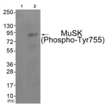 Western blot - MuSK (Phospho-Tyr755) Antibody from Signalway Antibody (11837) - Antibodies.com