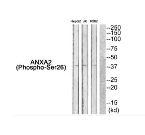 Western blot - ANXA2 (Phospho-Ser26) Antibody from Signalway Antibody (11839) - Antibodies.com