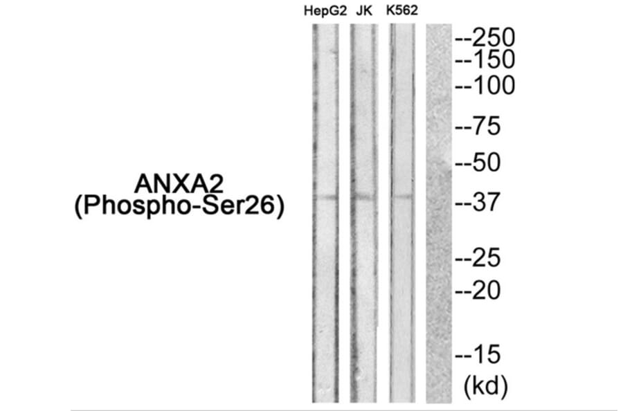 Western blot - ANXA2 (Phospho-Ser26) Antibody from Signalway Antibody (11839) - Antibodies.com