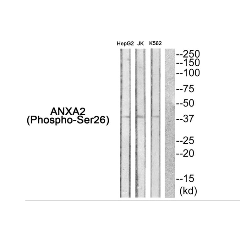 Western blot - ANXA2 (Phospho-Ser26) Antibody from Signalway Antibody (11839) - Antibodies.com