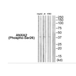 Western blot - ANXA2 (Phospho-Ser26) Antibody from Signalway Antibody (11839) - Antibodies.com