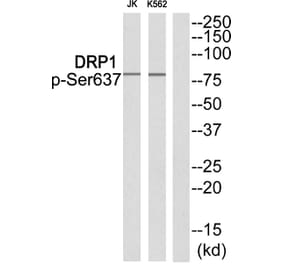 Western blot - DRP1 (Phospho-Ser637) Antibody from Signalway Antibody (11842) - Antibodies.com