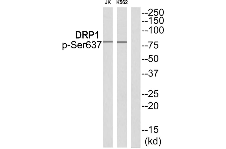 Western blot - DRP1 (Phospho-Ser637) Antibody from Signalway Antibody (11842) - Antibodies.com