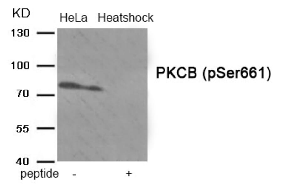 Western blot - PKCB (Phospho-Ser661) Antibody from Signalway Antibody (11905) - Antibodies.com