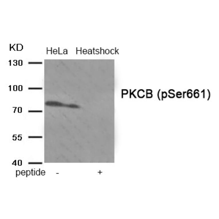Western blot - PKCB (Phospho-Ser661) Antibody from Signalway Antibody (11905) - Antibodies.com
