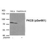 Western blot - PKCB (Phospho-Ser661) Antibody from Signalway Antibody (11905) - Antibodies.com