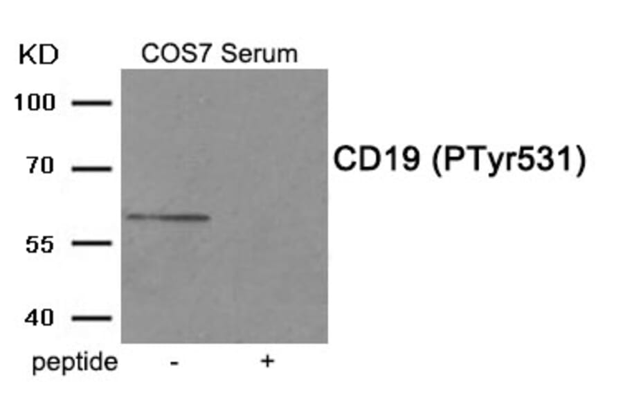 Western blot - CD19 (Phospho-Tyr531) Antibody from Signalway Antibody (11910) - Antibodies.com
